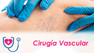 Cirujanos Vasculares en Quito.